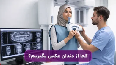 کجا از دندان عکس بگیریم؟