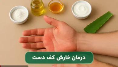 دلیل خارش کف دست و درمان خانگی